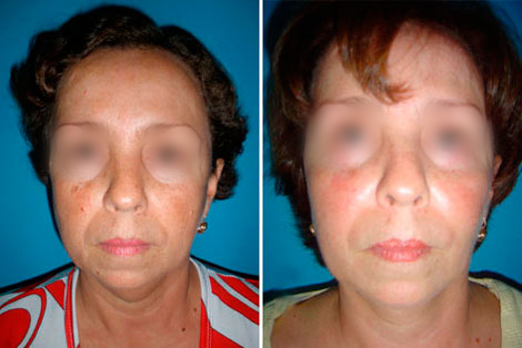 ritidoplastia, Doctor Luis Yesid Martínez Laguna